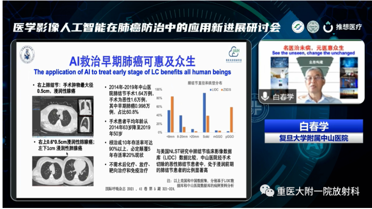助力肺癌精准诊疗,重医大附一院举办医学影像人工智能应用新进展研讨会 新闻资讯 第9张 助力肺癌精准诊疗,重医大附一院举办医学影像人工智能应用新进展研讨会 新闻资讯 第9张