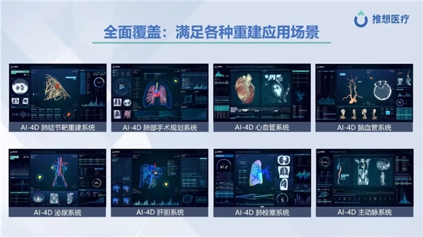 CMEF首日 | 推想全线产品亮相,重磅发布AI-4D平台 新闻资讯 第5张 CMEF首日 | 推想全线产品亮相,重磅发布AI-4D平台 新闻资讯 第5张