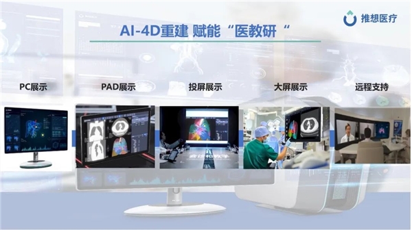 CMEF首日 | 推想全线产品亮相,重磅发布AI-4D平台 新闻资讯 第7张 CMEF首日 | 推想全线产品亮相,重磅发布AI-4D平台 新闻资讯 第7张